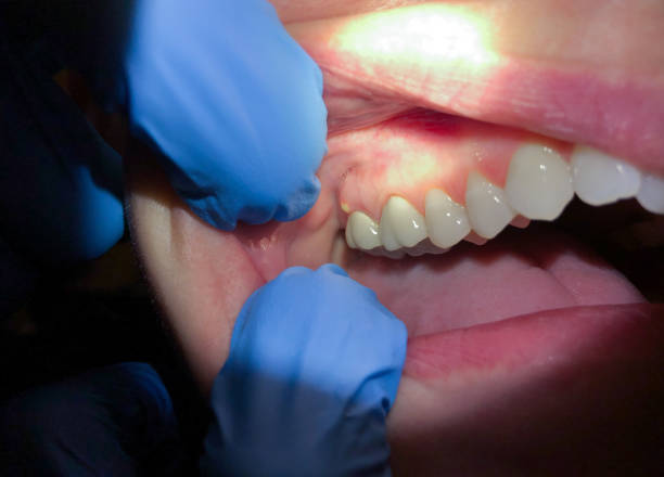 Best Emergency Orthodontic Repairs in Gardere, LA